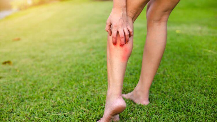 ¿Picaduras? Así debes protegerte